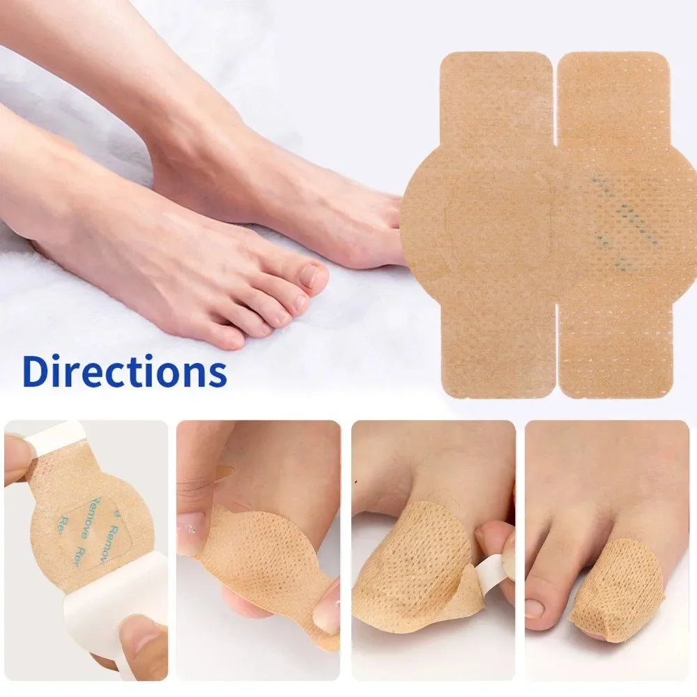 Waterproof Nail Fungus Patch Ingrown Toenail Correction Sticker Damaged Gray Nail Repair Care Feet Tools