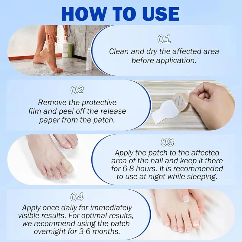 Nail Fungus Patch Waterproof Nail Repair Patch Ingrown Correction Sticker Damaged Nail Gray Care Patch Feet Care Tools