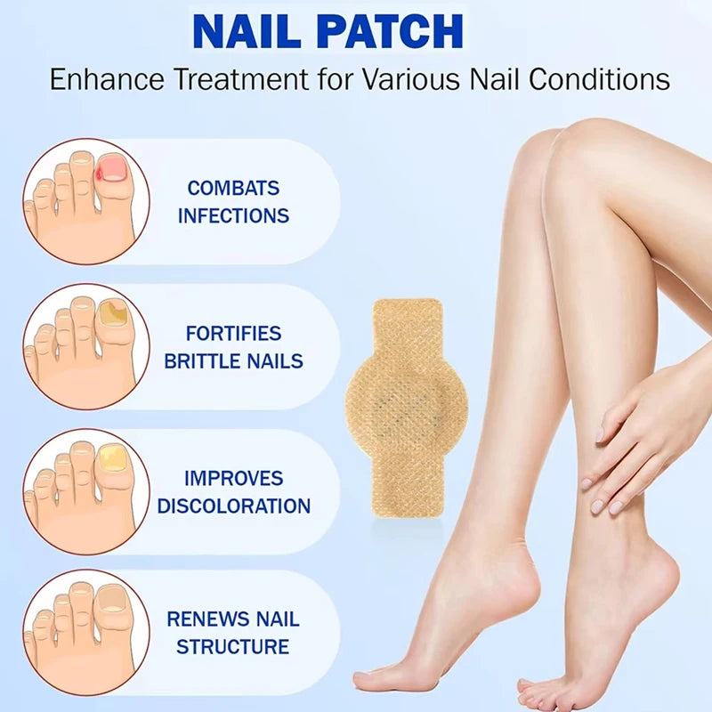Nail Fungus Patch Waterproof Nail Repair Patch Ingrown Correction Sticker Damaged Nail Gray Care Patch Feet Care Tools