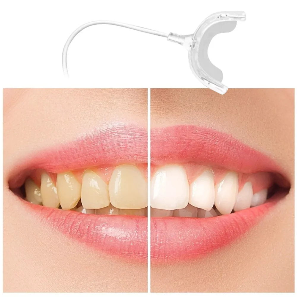 Teeth Whitening Accelerator Smart LED Blue Light Portable USB/iPhone/Android Charging Device Teeth Whitener Light Gum Tray