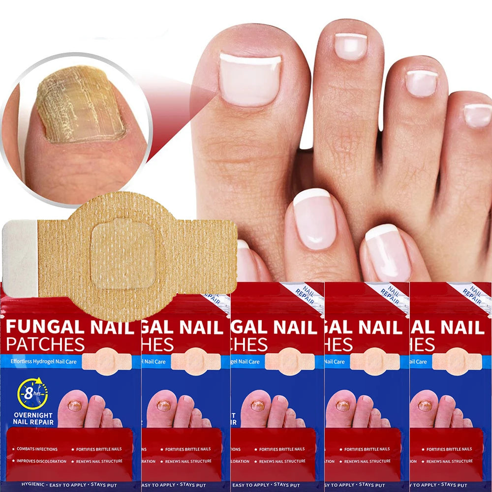 Waterproof Nail Fungus Patch Ingrown Toenail Correction Sticker Damaged Gray Nail Repair Care Feet Tools