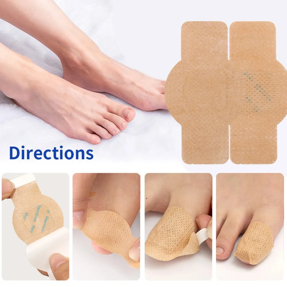 Waterproof Nail Fungus Patch Ingrown Toenail Correction Sticker Damaged Gray Nail Repair Care Feet Tools