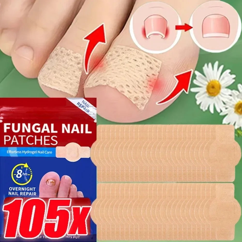 Waterproof Nail Fungus Patch Ingrown Toenail Correction Sticker Damaged Gray Nail Repair Care Feet Tools